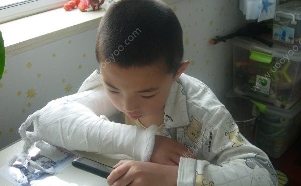 骨折取鋼板后需要多久恢復？骨折取鋼板要多久恢復？(1)