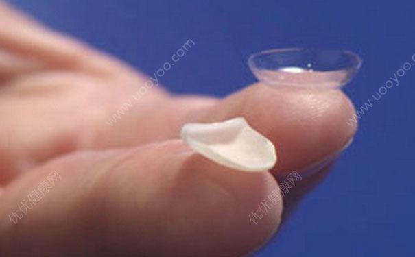 牙齒貼面多少錢一顆？牙齒貼面修復多少錢？(1)