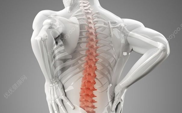 腰椎間盤突出有哪些表現(xiàn)？腰椎間盤突出的主要癥狀(1)