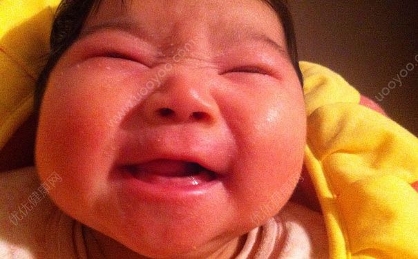 寶寶濕疹流黃水怎么辦？寶寶濕疹流水怎么處理？(1)