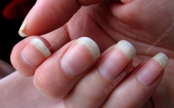 指甲長(zhǎng)得快是什么原因？指甲長(zhǎng)的快是怎么回事？(1)