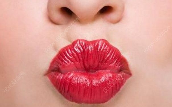 嘴唇上有黑斑是什么原因？嘴唇上有黑斑怎么去除？(5)