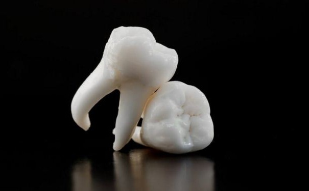 女性拔智齒能瘦臉嗎？智齒是否應(yīng)該拔？(1)