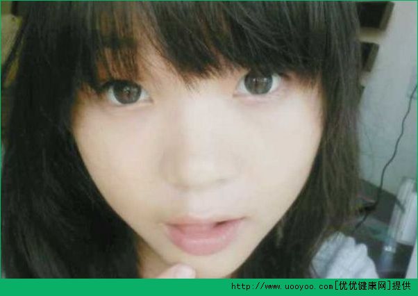 我13歲臉上有很多痣怎么辦？13歲為什么臉上有很多痣？(4)