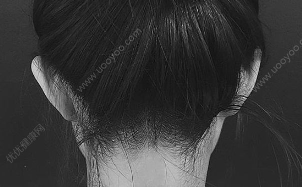 后腦勺痛是什么原因？后腦勺痛怎么快速緩解？(1)