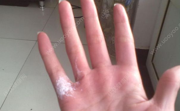 手被502粘住了怎么辦？手被502膠水沾到怎么洗掉？(3)
