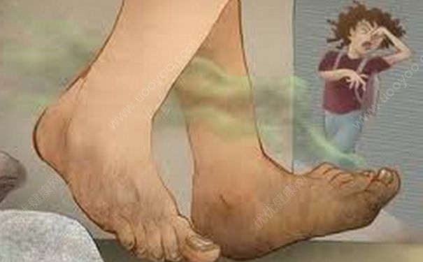腳臭引發(fā)血案 腳臭怎么根治？(2)