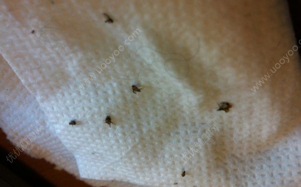 飛蟲進(jìn)鼻子里怎么辦？小飛蟲飛到鼻子里(4)