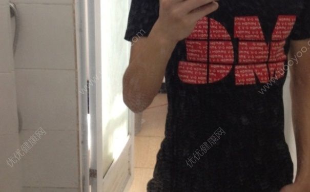 吃不胖的人是什么原因？吃不胖的人是不是有??？(1)