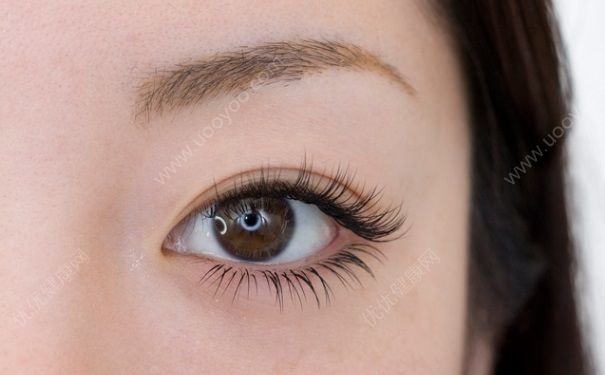 睫毛進(jìn)眼睛里出不來怎么辦？睫毛進(jìn)眼睛里找不到怎么辦？(5)