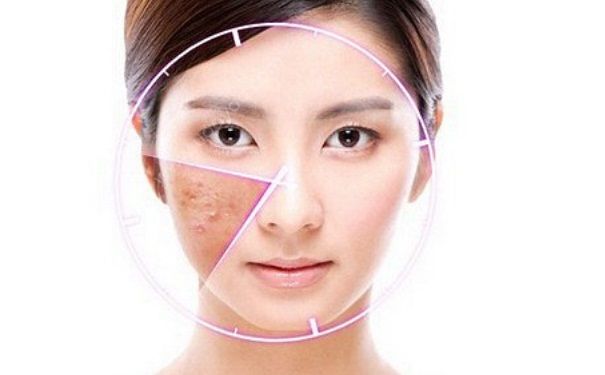 激素臉怎么治？激素臉怎么調(diào)理？(2)