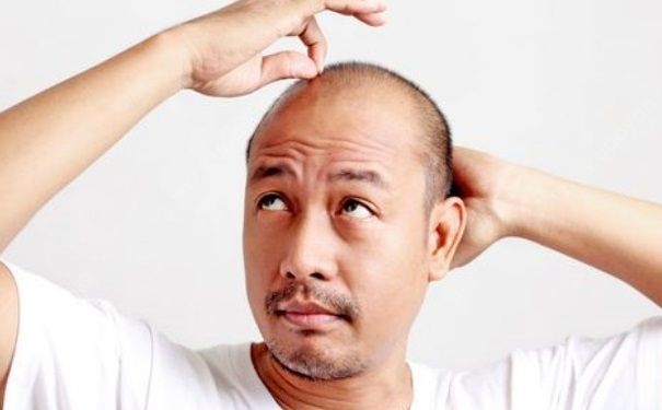 每天掉頭發(fā)怎么回事？每天掉頭發(fā)要怎么治療？(1)