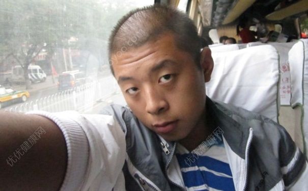 每天掉頭發(fā)怎么回事？每天掉頭發(fā)要怎么治療？(3)