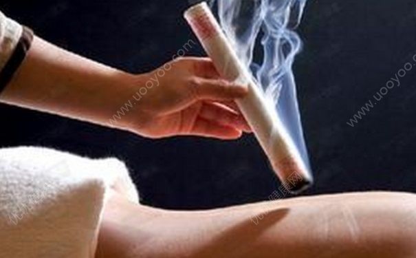 艾灸能糾正胎位嗎？艾灸糾正胎位的方法(2)