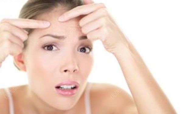 痘痘能不能擠掉？臉上長痘痘能不能擠？(1)