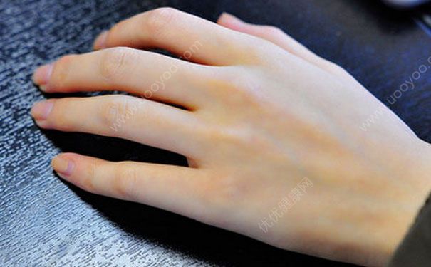 手腳多汗是什么原因？手腳多汗癥怎么根治？(4)