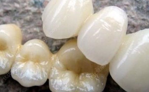 活動(dòng)假牙影響咀嚼 活動(dòng)假牙好還是固定假牙好？(1)