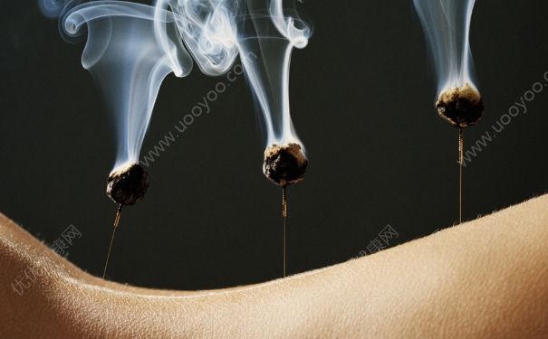 腰肌勞損針灸有用嗎？腰肌勞損針灸治療方法(1)