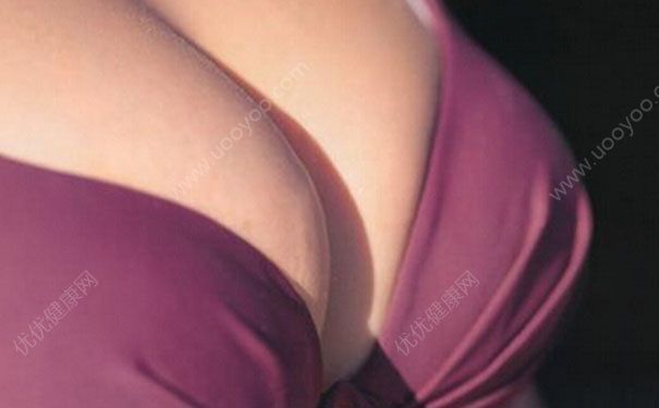乳腺增生的癥狀表現(xiàn)有哪些？乳腺增生怎么治最好？(1)