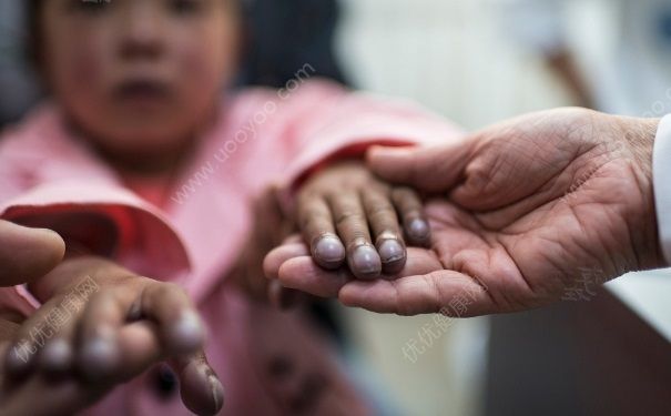 先天性心臟病是什么原因造成的？先天性心臟病是怎么引起的？(1)