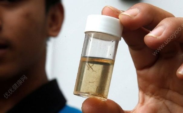 寨卡病毒初期癥狀有哪些？如何判斷是否感染寨卡病毒？(1)