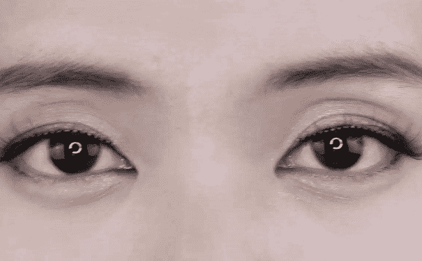 眼睛腫的原因是什么？眼睛腫了如何處理？(1)
