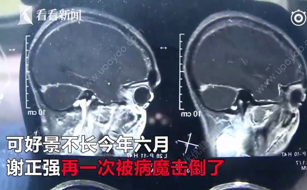 23歲小伙與癌癥抗?fàn)幜?，自愿捐獻(xiàn)遺體樂觀面對(duì)死亡(3)
