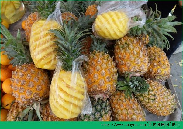 膽結(jié)石可以吃菠蘿嗎？膽結(jié)石吃菠蘿好不好呢？(2)