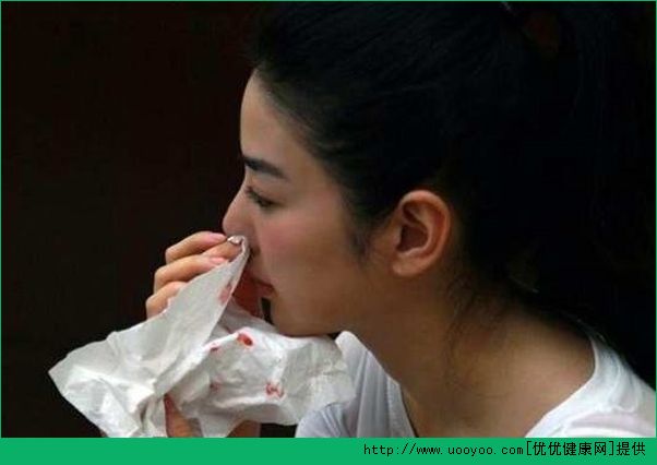 中年人為什么會流鼻血？中年流鼻血是怎么回事？(1)