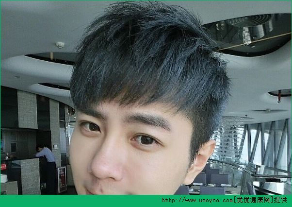 15歲長白頭發(fā)怎么辦？長了白頭發(fā)吃什么好？(2)