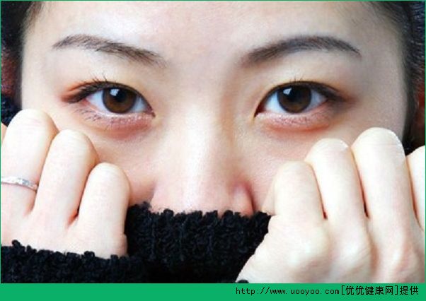 早上起床眼睛腫了怎么辦？早上眼睛腫了怎樣消腫？(1)