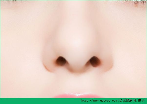 鼻囊炎的癥狀是什么？鼻囊炎有哪些癥狀？(2)