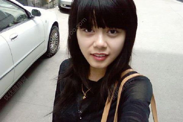 青少年有黑眼圈怎么辦？青少年黑眼圈怎么祛除？(4)