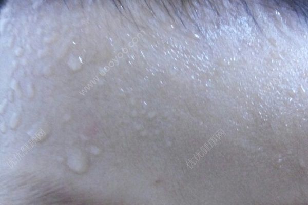 晚上睡覺出汗怎么回事？晚上睡覺出汗怎么調(diào)理？(2)