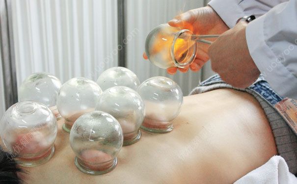 拔罐后可以冼澡嗎？拔罐后多久才可以冼熱水澡？(1)