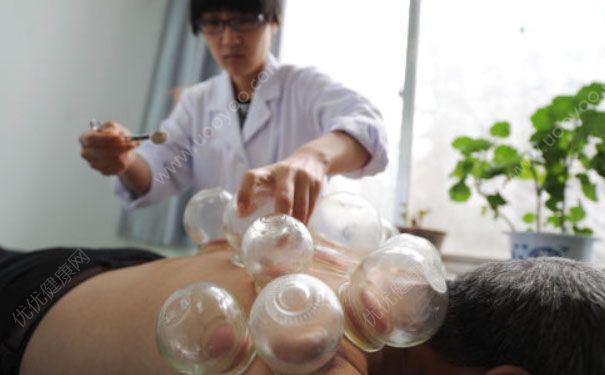 拔罐后可以冼澡嗎？拔罐后多久才可以冼熱水澡？(4)