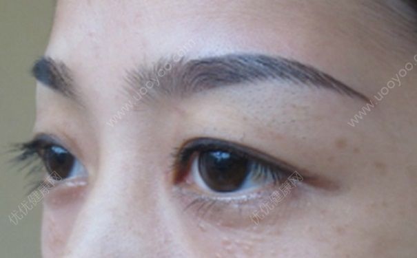 夏天可以繡眉嗎？夏天繡眉好不好？(3)
