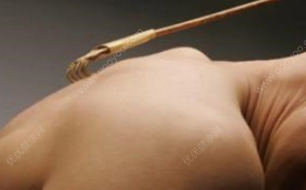 吃中藥治療蕁麻疹？中醫(yī)可以治療蕁麻疹嗎？(1)