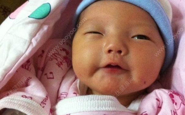 青少年黃疸癥狀有哪些？青少年黃疸怎么治？(2)