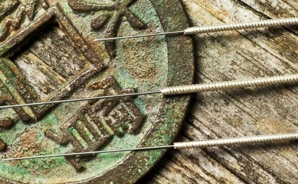 針灸能不能天天做呢？針灸天天做好嗎？(2)