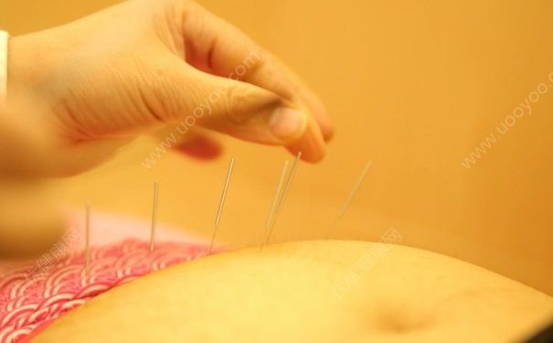 針灸可以調(diào)理內(nèi)分泌嗎？針灸能治療內(nèi)分泌失調(diào)嗎？(3)