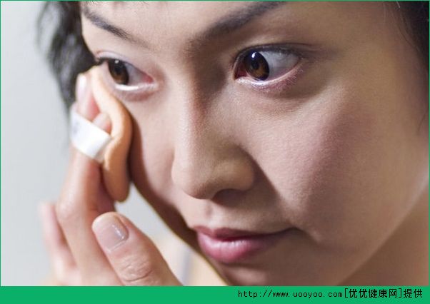 眼睛疾病有哪些癥狀？眼睛疾病的癥狀解疑(5)