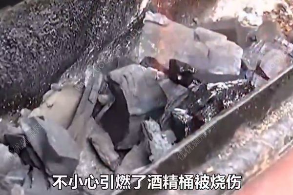 不慎引燃酒精桶，男子家中吃燒烤吃成三度燒傷(3)