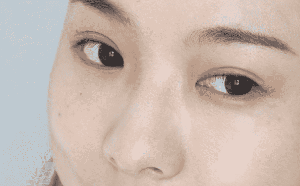 祛黑頭的誤區(qū)有哪些？祛黑頭有什么誤區(qū)？(1)