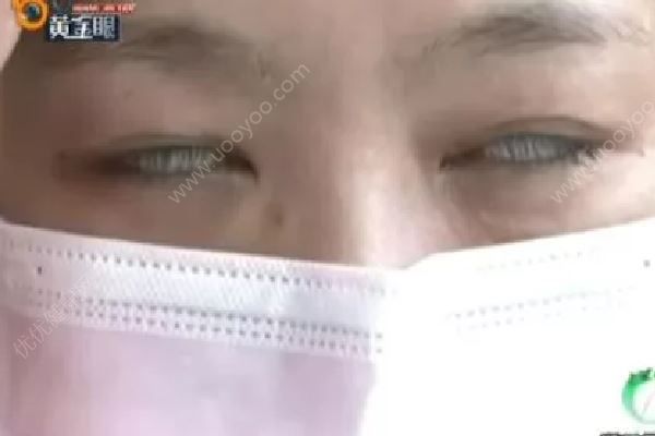 女子美容院出來眼睛合不上，睡覺要用膠帶粘眼皮(3)