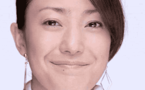 玻尿酸去法令紋效果怎么樣？玻尿酸去法令紋效果好不好？(1)