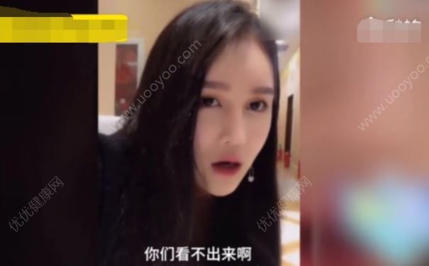趙本山女兒承認(rèn)整容，整容前怎么調(diào)整心態(tài)？(4)