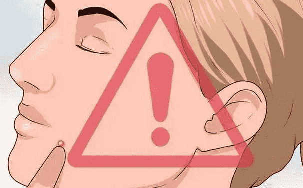 閉口粉刺去除的方法是怎樣的？如何有效的美白皮膚？(1)