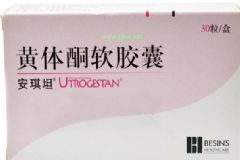 服用黃體酮的最佳時(shí)期？服用黃體酮有哪些注意事項(xiàng)？[圖]