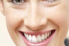 牙齒美白膠多少錢？iree牙齒美白膠[圖]